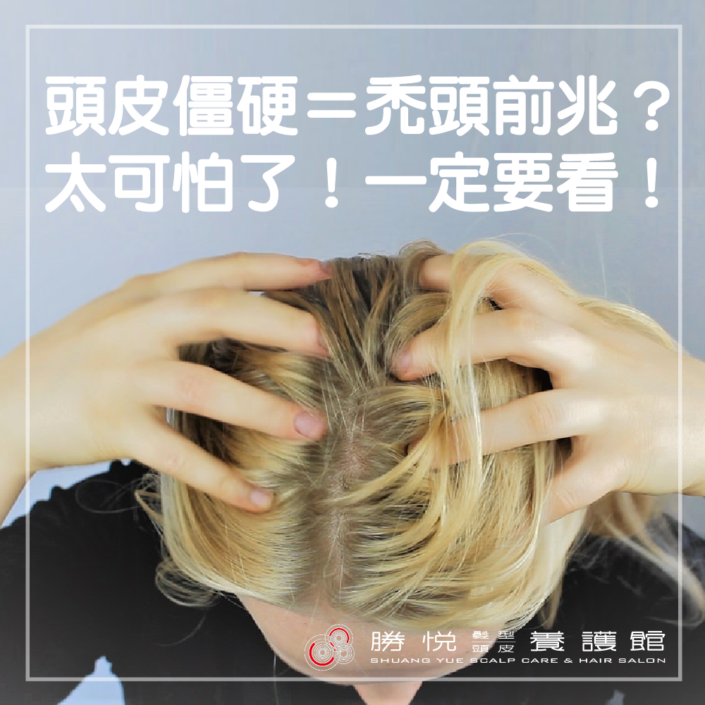 頭皮僵硬竟然是禿頭前兆？太可怕了！