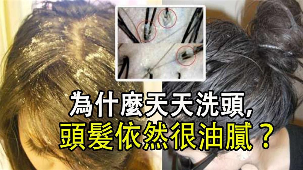 其實，洗頭次數太頻繁一樣出油。